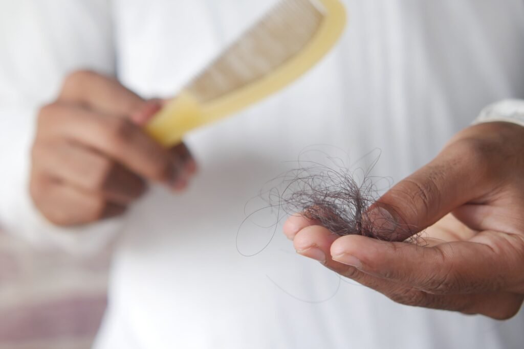 protein deficiency hair loss